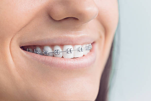 Best Teeth Whitening  in Fallston, MD